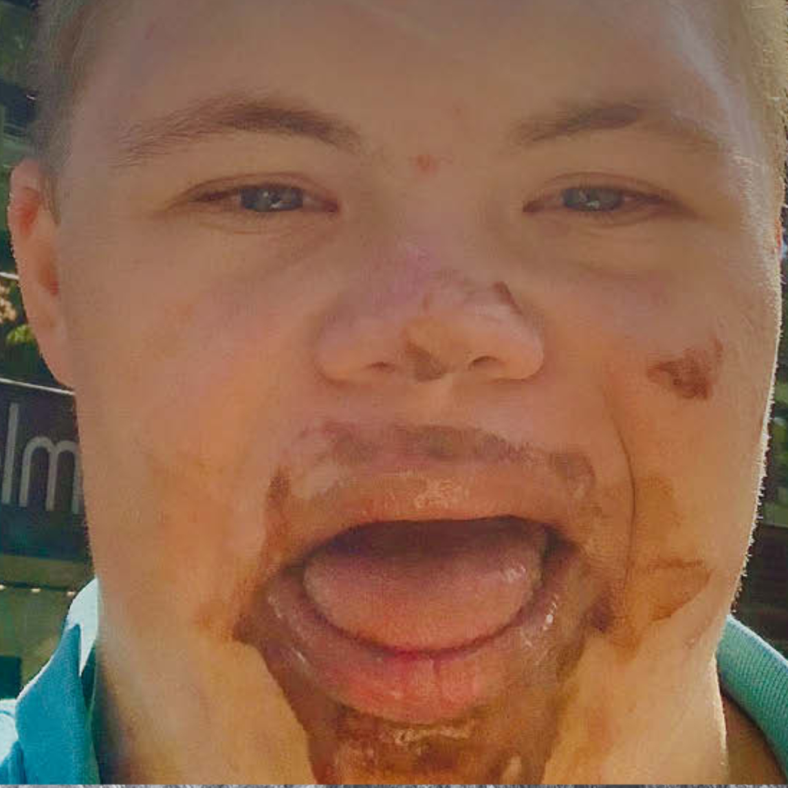 Ein junger Mann ist frontal im Freien fotografiert und blickt mit geöffnetem Mund in die Kamera. Im Mund- und Kinnbereich sind braune Verschmutzung...